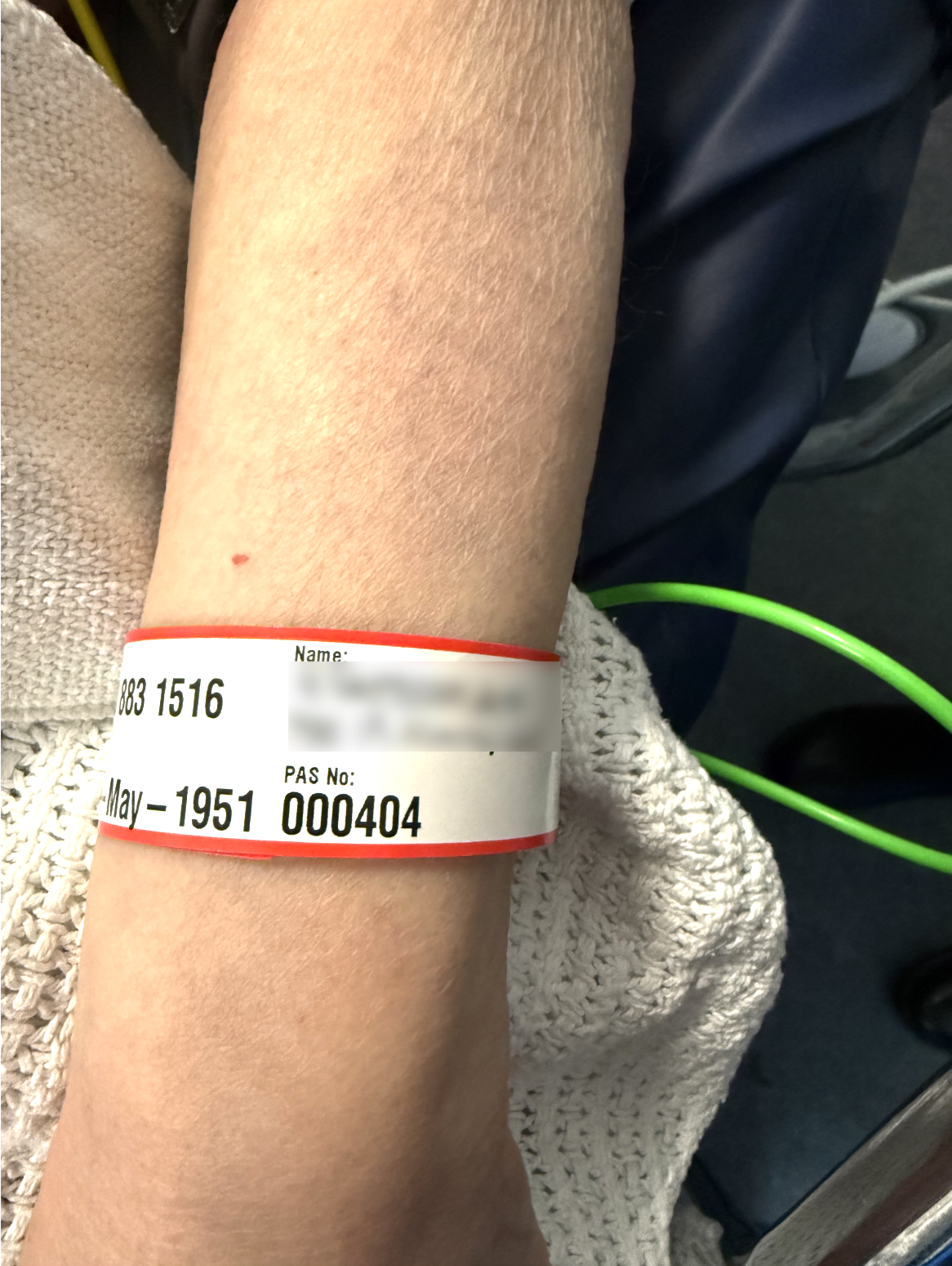 A patient wrist band with the PAS number as 000404 